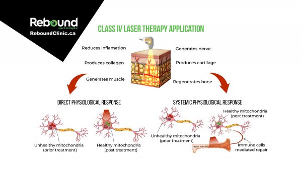 Laser Therapy Infographic